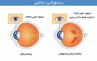 دفاع از پروپوزال آقای حسین حسینی دانشجوی کارشناسی ارشد تغذیه به راهنمایی جناب آقای دکتر رسول زرین